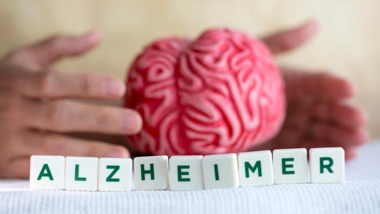 Des signes précoces de la maladie d&rsquo;Alzheimer découverts chez des quadragénaires