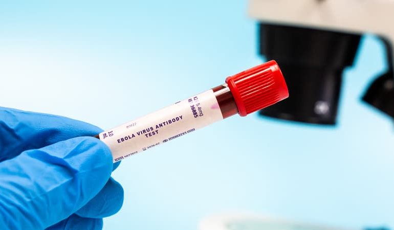 Nouvelle épidémie d&rsquo;Ebola en République démocratique du Congo