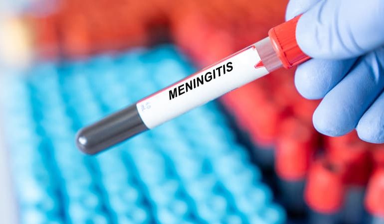 La méningite en Angleterre: cas récents et mesures de précaution