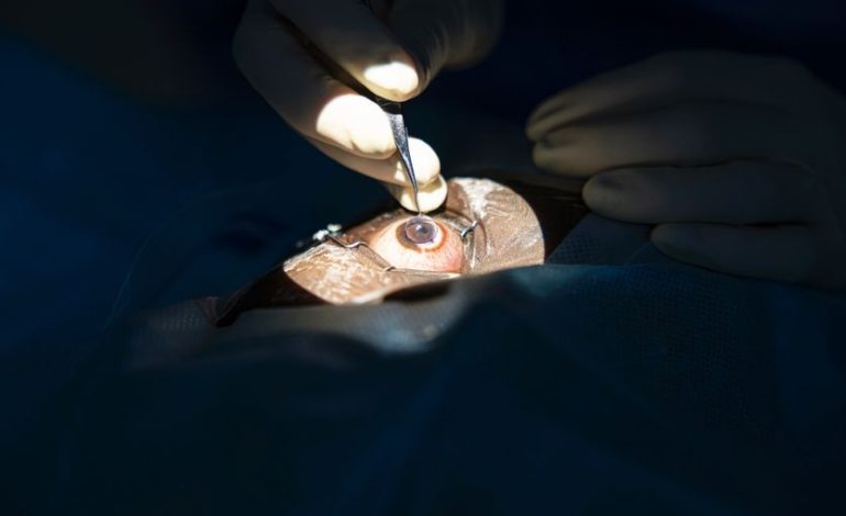 La greffe de cornée en France : Un espoir pour de nombreux patients