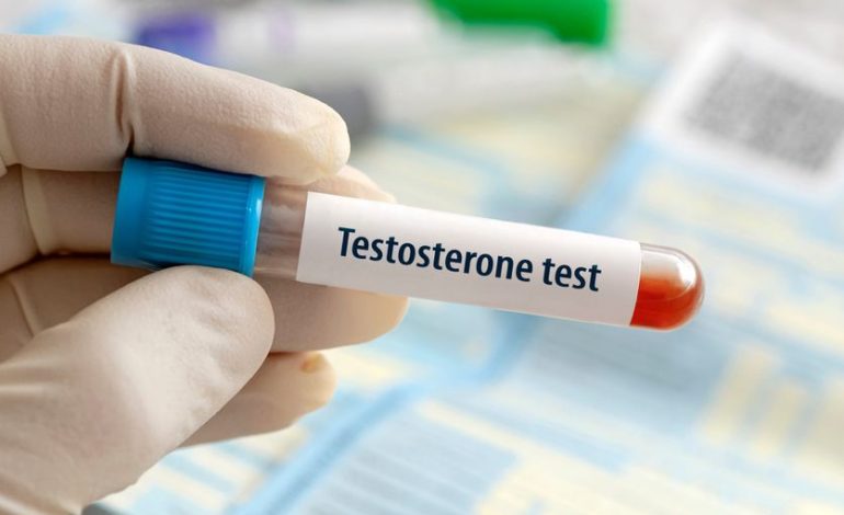 Le rôle de la testostérone chez les femmes : entre réalité et mythes