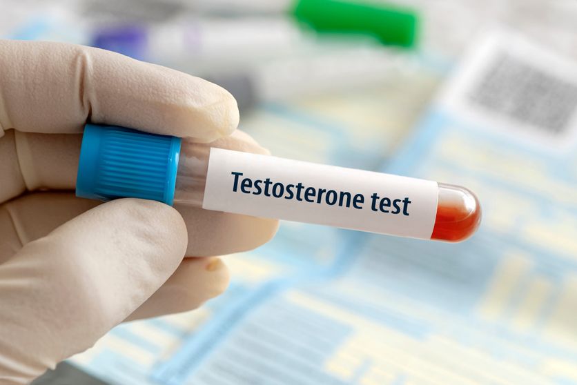 Le rôle de la testostérone chez les femmes : entre réalité et mythes