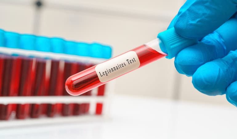 Deux décès dus à une augmentation des cas de légionellose en Savoie