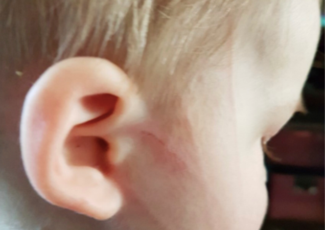 Une Traque Médicale Complexe : L&rsquo;Histoire d&rsquo;un Enfant en Ontario