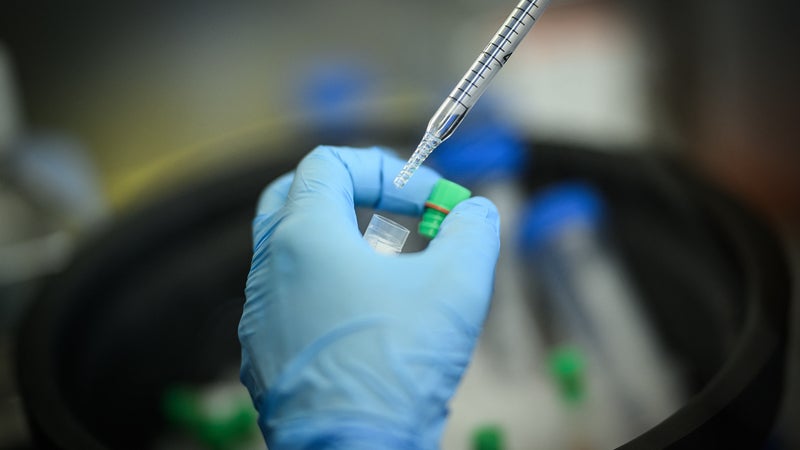 Les vaccins anti-cancer : avancées et défis