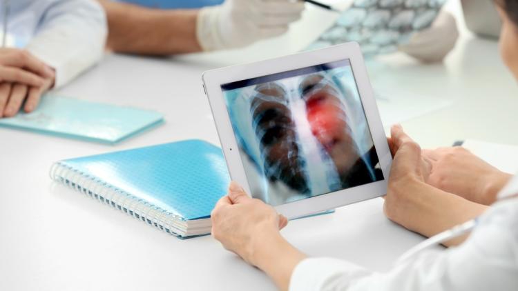 Signes indiquant une mauvaise santé pulmonaire