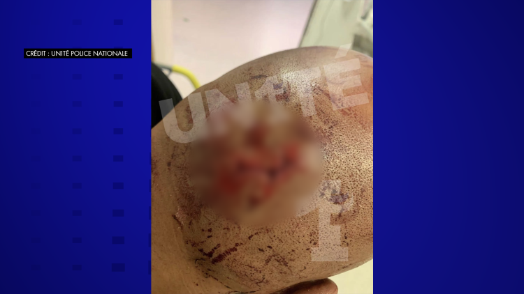 Violences à Saint-Pierre-des-Corps : Neuf policiers blessés