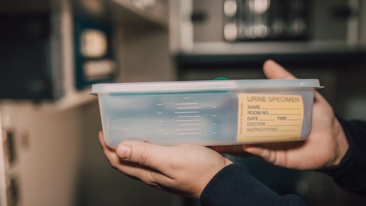 Tests urinaires pour détecter les cancers de la vessie