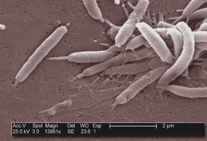 Part des Cancers Attribuables aux Infections en 2024