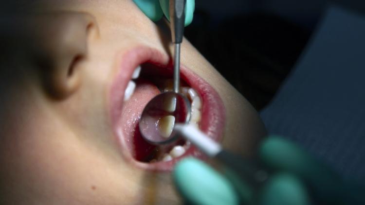Réduction du remboursement des soins dentaires par l’Assurance maladie