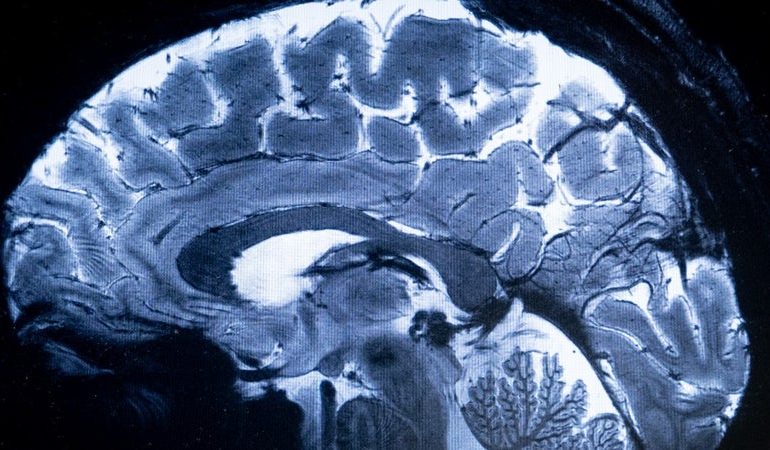 Les révélations sur le cerveau humain par Stanford