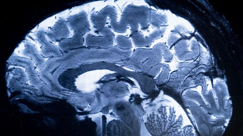 Les révélations sur le cerveau humain par Stanford