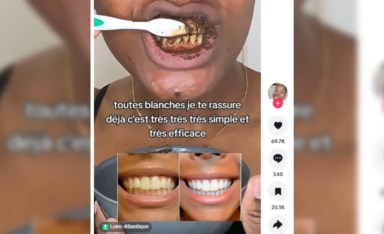 Les dangers des recettes maison pour blanchir les dents sur les réseaux sociaux