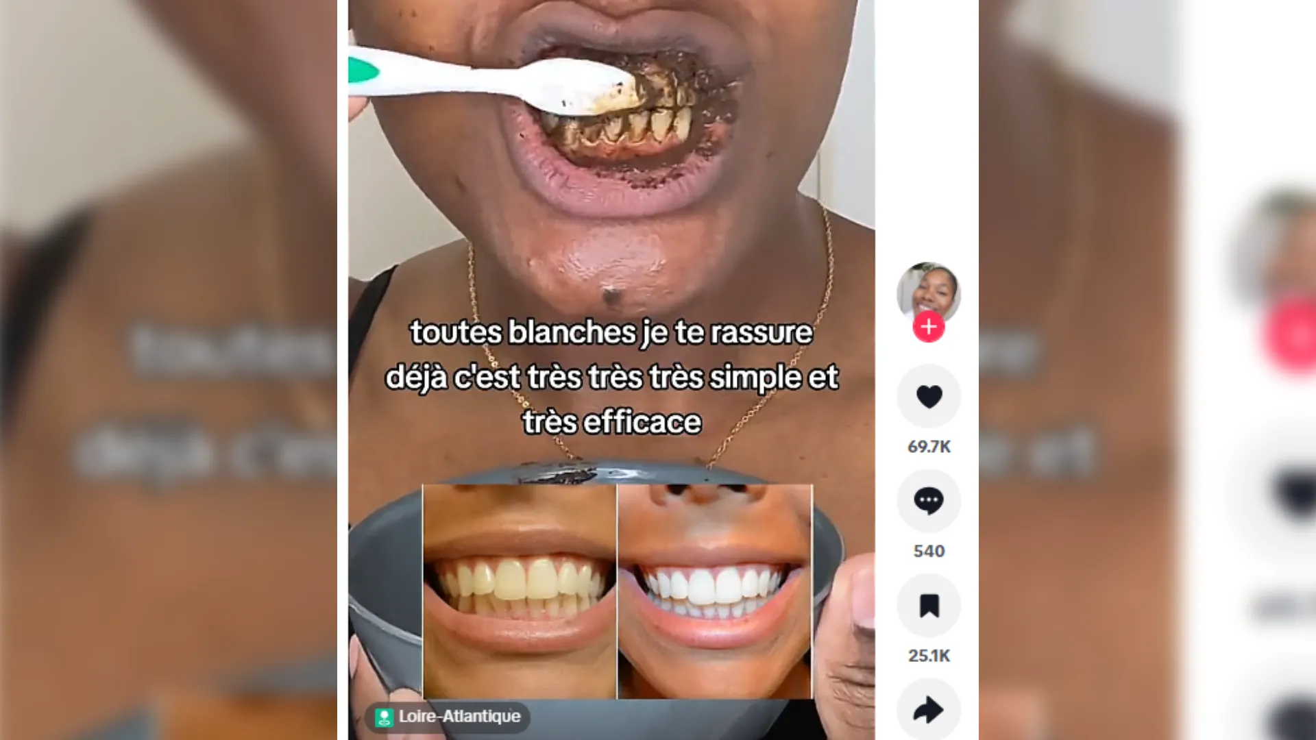 Les dangers des recettes maison pour blanchir les dents sur les réseaux sociaux