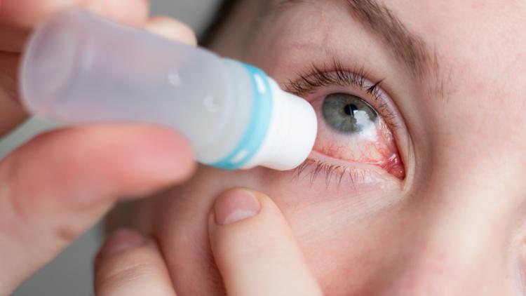 Soulager les yeux irrités par un corps étranger