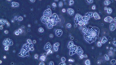 Amoéba : Une nouvelle stratégie orientée vers le biocontrôle agricole et les cosmétiques